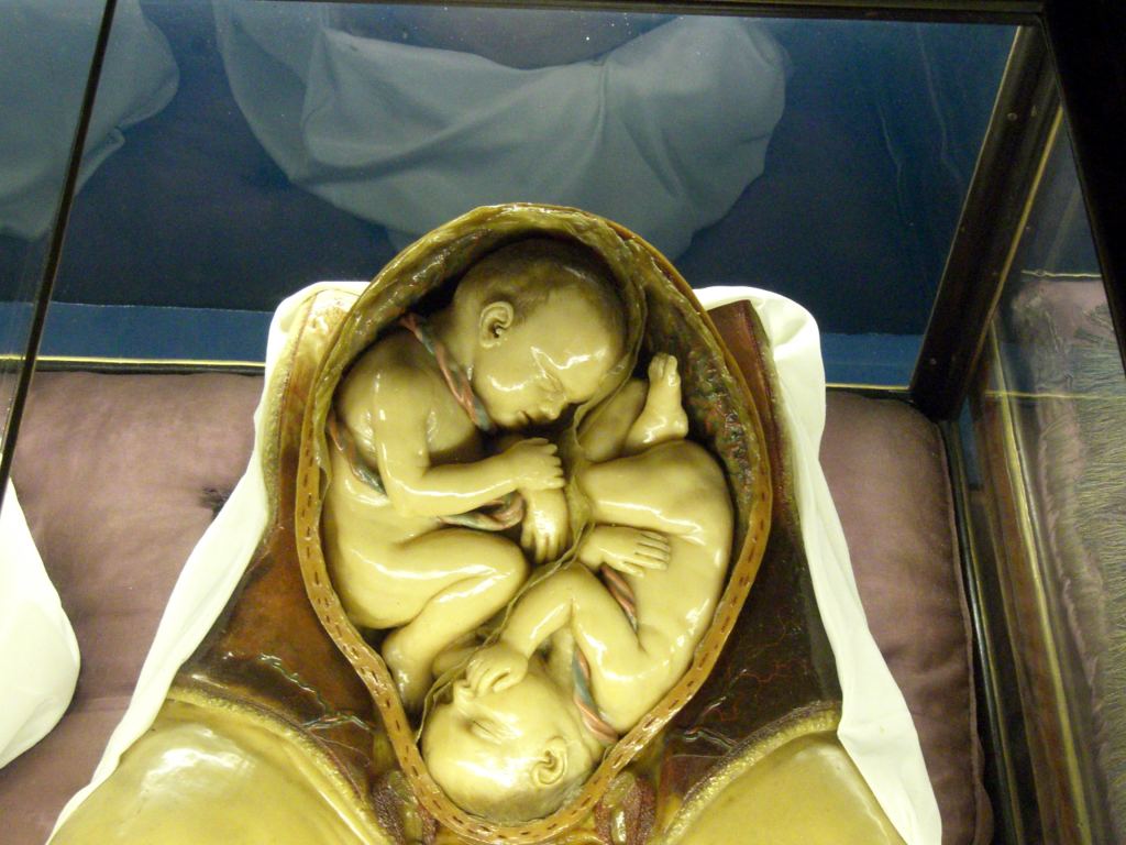 Фото 68 - Венгерский Национальный Музей естественной истории